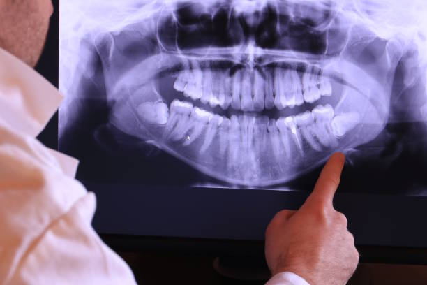 Best Knocked-Out Tooth Emergency  in Pleasant Hills, OH