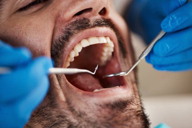 Best Broken Tooth Emergency  in Pleasant Hills, OH